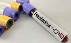 Hantavirüs salgına dönüşür mü? Kapalı alan temizliğinde büyük risk
