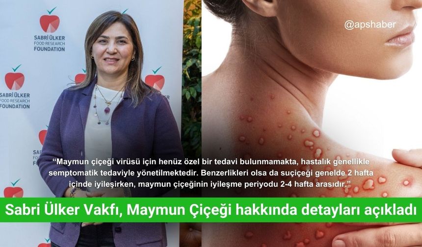 Sabri Ülker Vakfı, Maymun Çiçeği hakkında detayları açıkladı